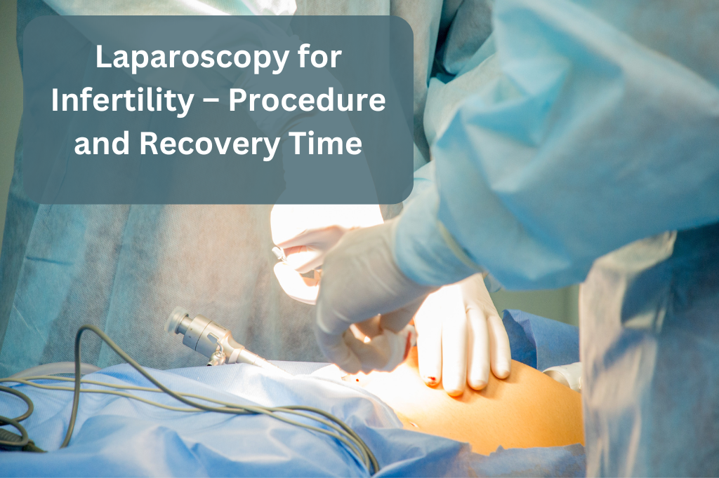 Laparoscopy for Infertility-Procedure and Recovery