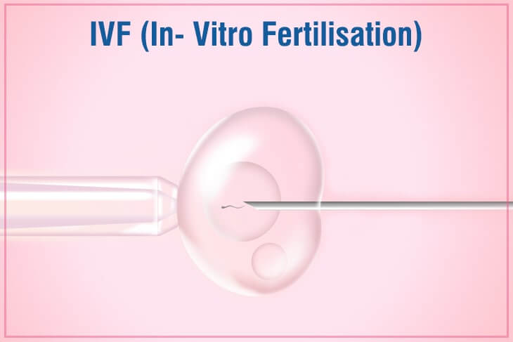 IVF Fertility Center